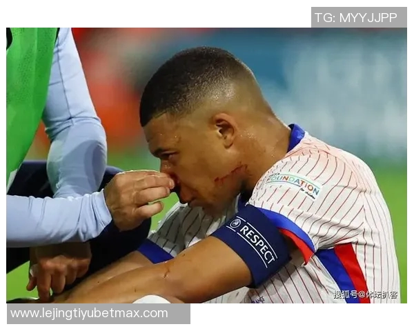 姆巴佩左膝不适与手指骨折仍执意出战展现求战决心